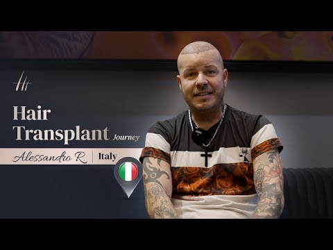 Here is Alessandro Restelli's Hair Transplant Journey !