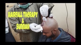 Hijama Treatment ( Hairfall | Dandruff |Skincare | Paralise | Etc... ) Therapy &amp; Sunnah ❤