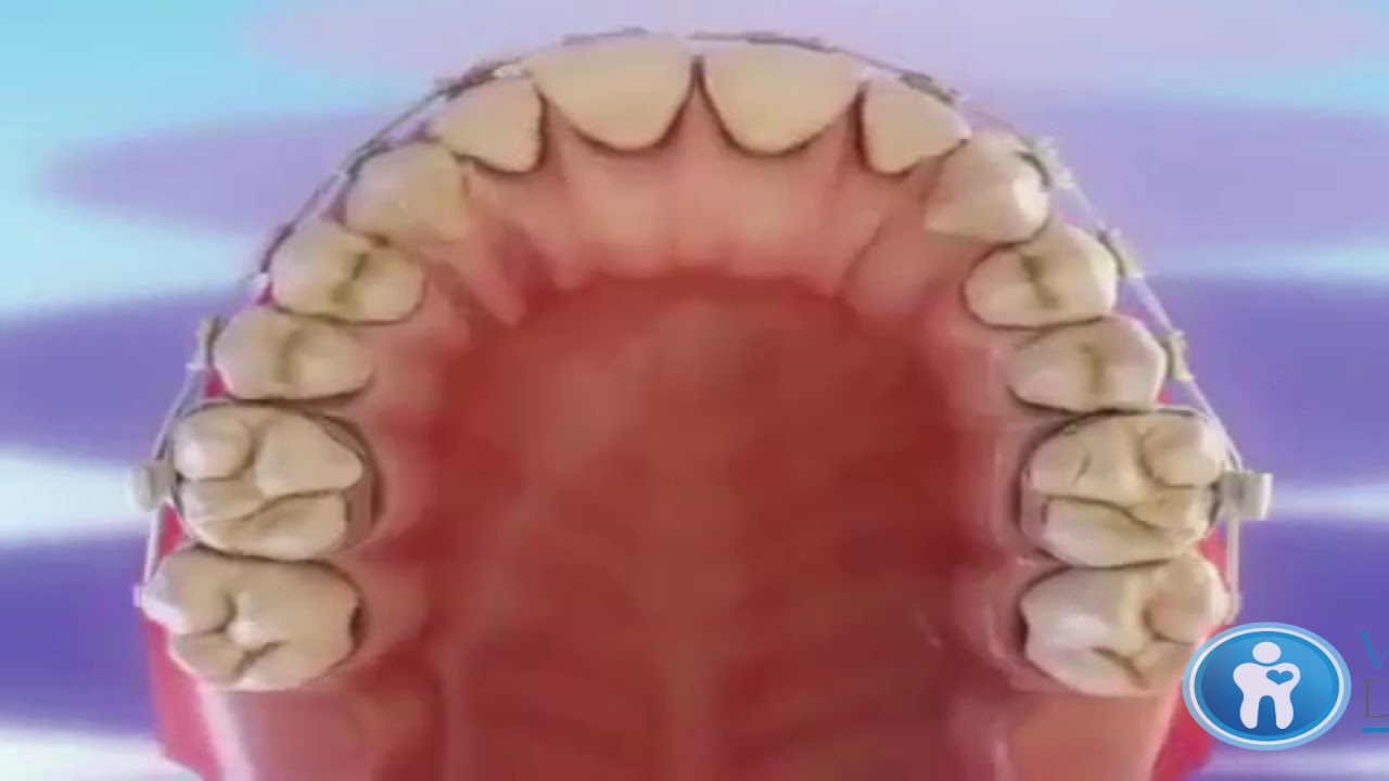 Leticia Hernández-38