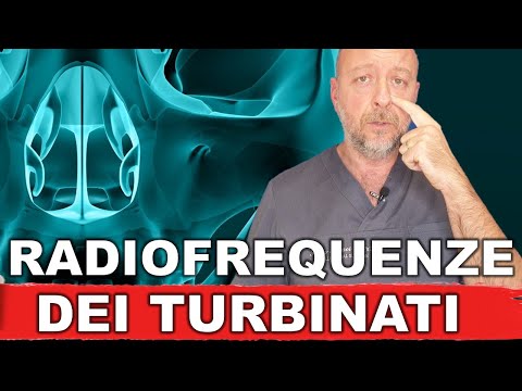 Radiofrequenza turbinati