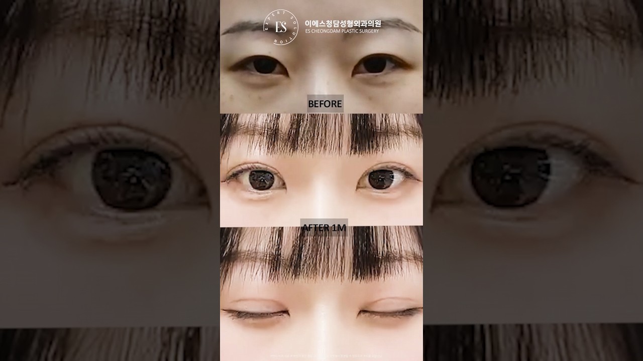이에스 유튜브