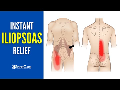 How to Instantly Relieve Iliopsoas Muscle Tightness (AND PAIN!)