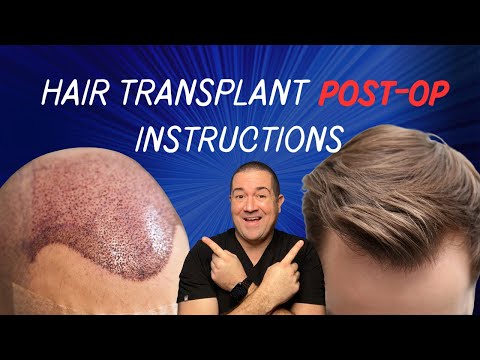 What To Expect After Your Hair Transplant || Hair Transplant Austin, Texas