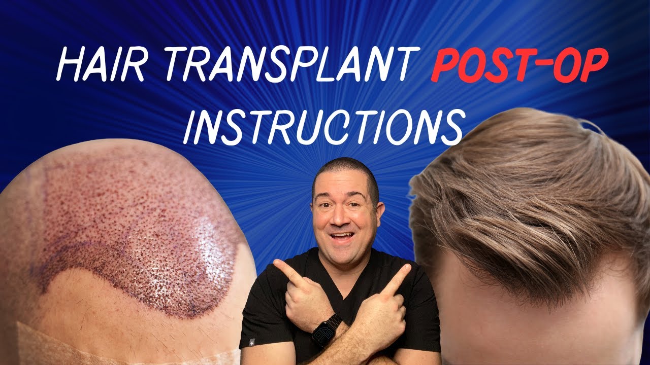 What To Expect After Your Hair Transplant || Hair Transplant Austin, Texas
