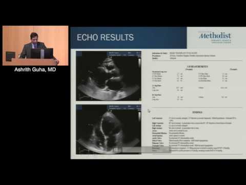 Team Approach to Management of Cardiogenic Shock (Ashrith Guha, MD)
