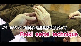 パーキンソン症状の筋固縮を開放した例