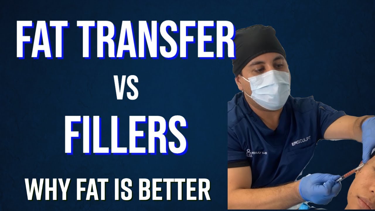 What is the difference between Fat Transfer vs Fillers- Beautifill® by Dr. Milanes, MD