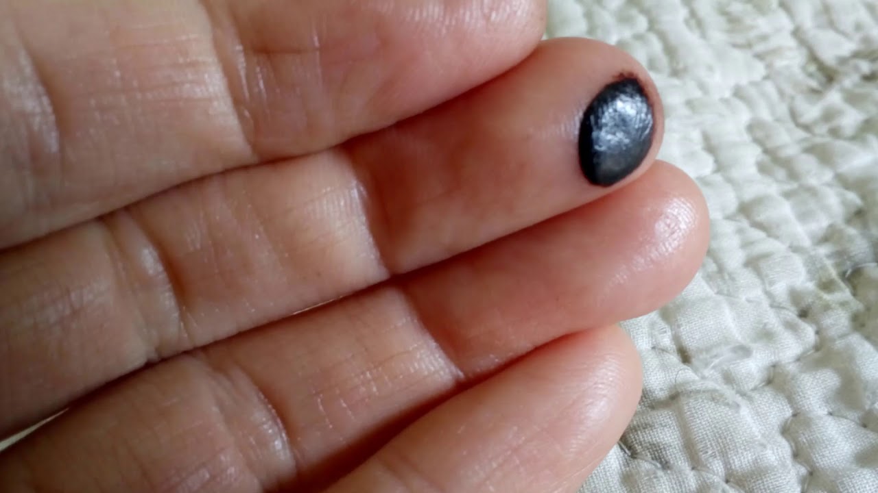 УДАР пальчика * КРОВЬ* запеклась. Наблюдение.