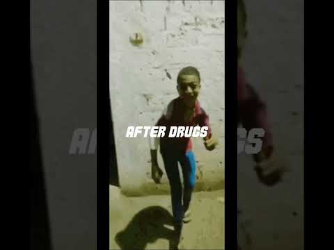 Soccer players before and after drugs *Mbappe edition* #shorts