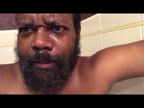 Lui lepki cracked  yellowman (buster)in the face He is laying about cancer/which is cancer per c