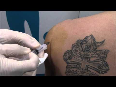 Un médico trata la enfermedad de la articulación de la cadera Dolor de espalda baja departamento de asesoramiento lumbar