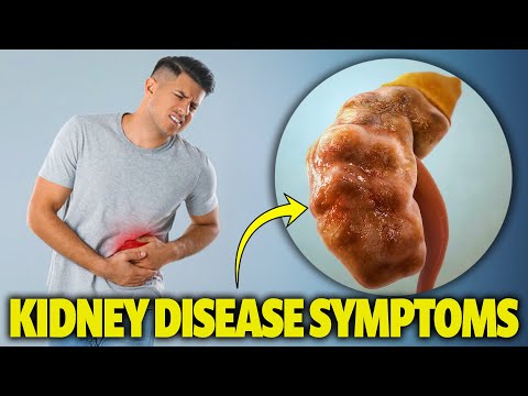 Kidney Disease Stage 3, 4 & 5 Symptoms. The Most Common Chronic Kidney Disease Symptoms