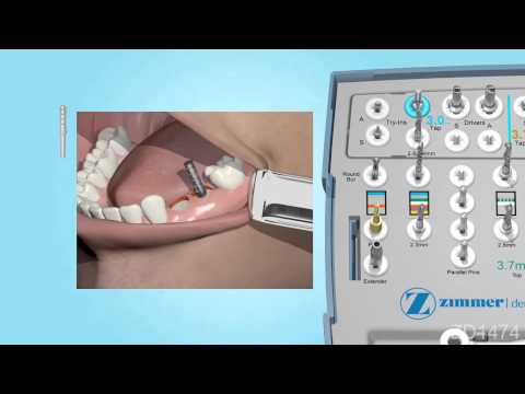 Surgical kit - step by step