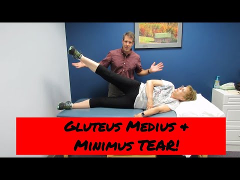 Gluteus Medius and Minimus tear vs. Greater Trochateric Bursitis