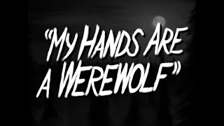 My Hands Are a Werewolf