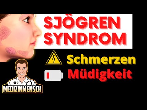 Schmerzen & Bleierne Müdigkeit Den Ganzen Tag 😴 POLYNEUROPATHIE beim Sjögren Syndrom (Arzt erklärt)