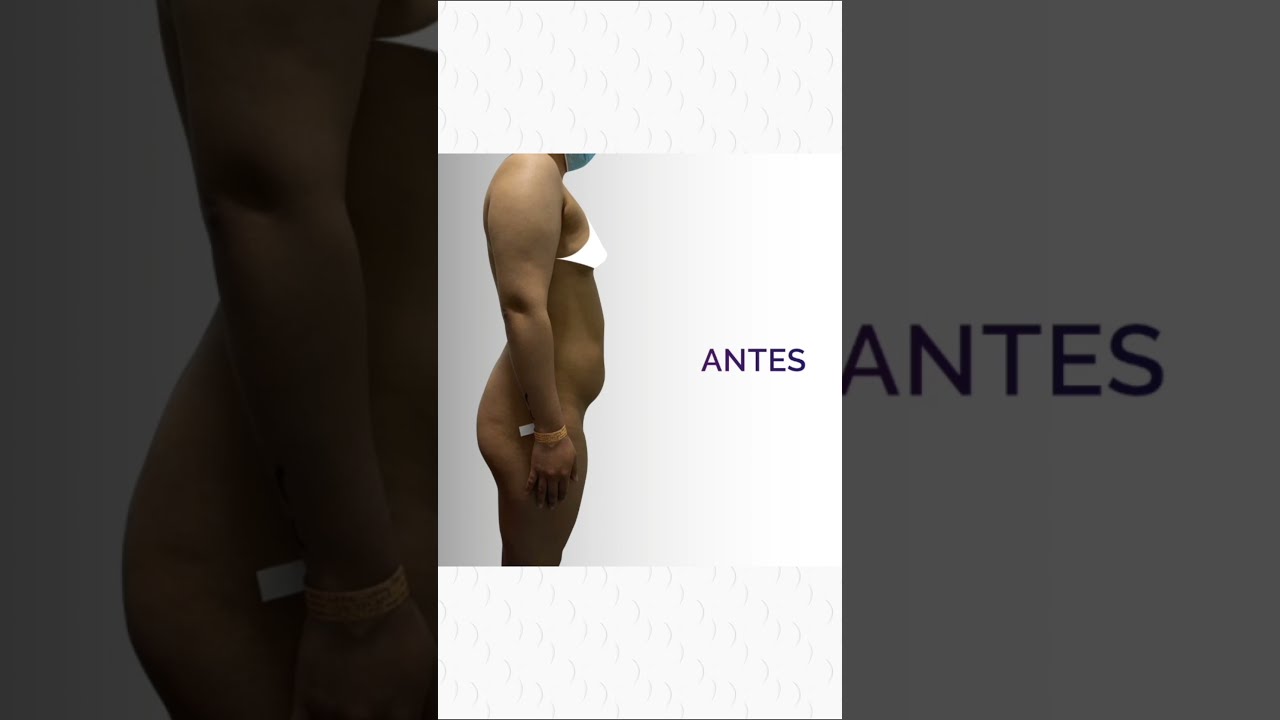 Alexander Mendoza-78