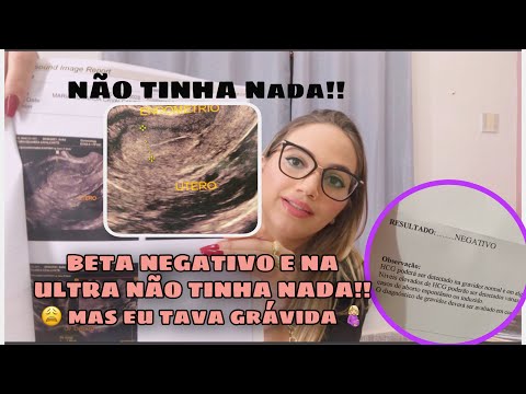 BETA HCG NEGATIVO E TAVA GRÁVIDA 🤰🏼😱 NA ULTRA NÃO TINHA NADA!!!!