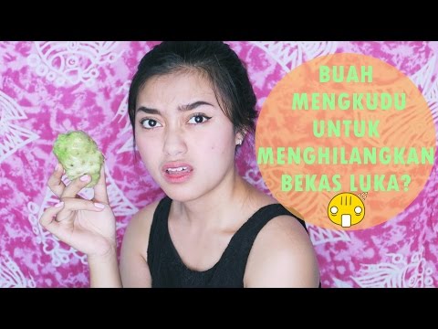 Transmisi kehilangan berat badan dengan bintang Bagaimana untuk menyingkirkan rasa sakit di perut