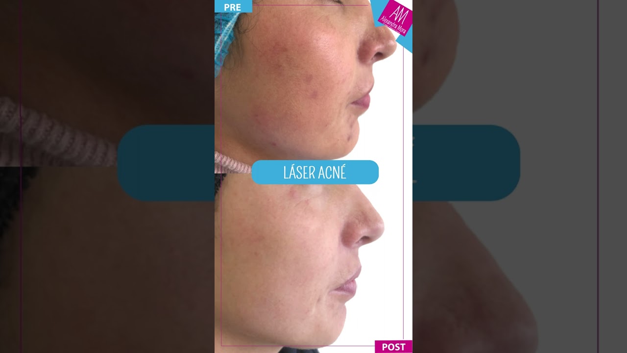 Alexandra Mora Hernandez-119