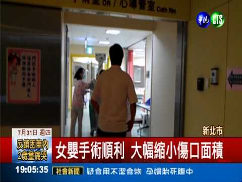 電毯燙嬰恐敗血症 成功縮小傷口