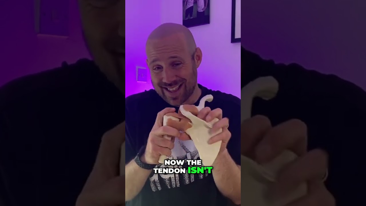 Why Your Shoulder Muscle Causes Pain at 90 Degrees