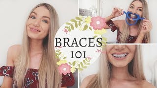 Braces: Everything You Need To Know | Price, Pain, Duration, Types!