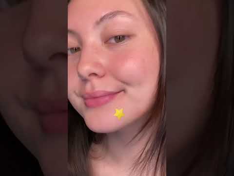 testing out the starface pimple patches!