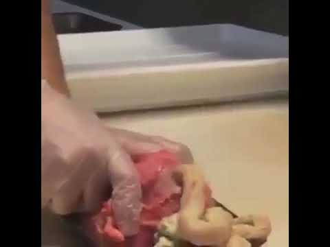 Registri vermi in uno stomaco Come mettere vermi sotto aceto a donne incinte