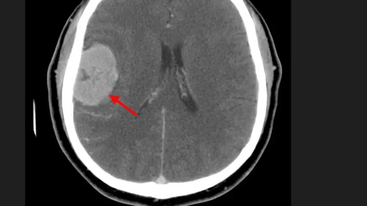 High Yield CT Scans (Part 2) || USMLE