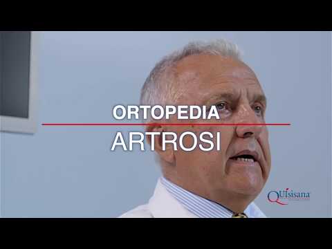 Ginocchio artroscopia Krasnoyarsk Cerotto osteocondrosi lombare