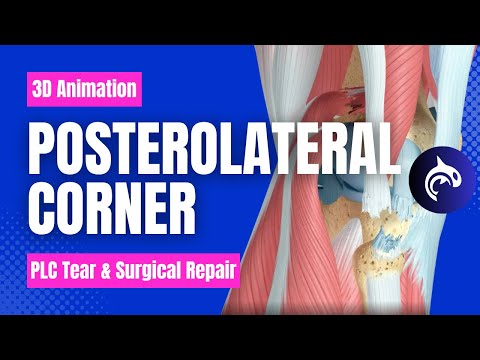 ACL Anterior Cruciate Ligament MCL Medial Collateral Ligament Tear and Repair No Narration