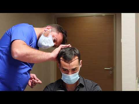 Florian's Hair Transplantation Experience!
