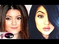 KYLIE JENNER Before and After: Plastic Surgery? - YouTube