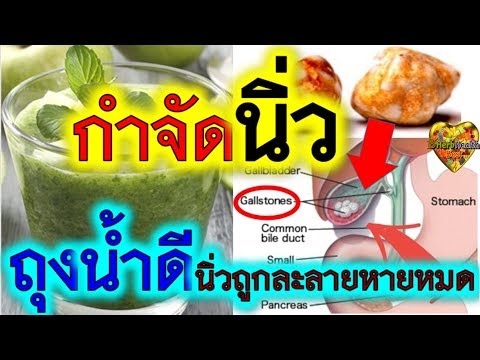 โรคสะเก็ดเงินกำมะถันน้ำมันดิน การรักษา neurodermatitis ใน Togliatti