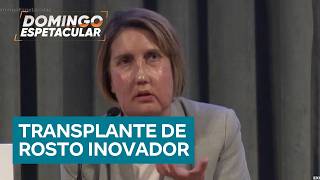 Woman donates her face before dying, helping victim of a serious infection.