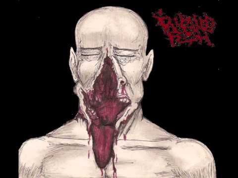 Impaled Flesh   Infection of the Putrid Body Live