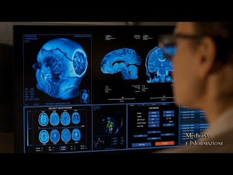 SCLEROSI MULTIPLA: nuove conoscenze, diagnosi, le terapie più efficaci per bloccare la progressione