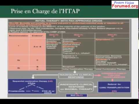 Des moyens simples pour traiter lhypertension Papazol boire sous haute pression
