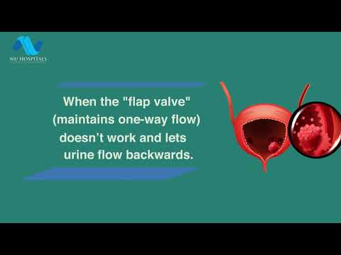 What is Vesico-Ureteral Reflux?