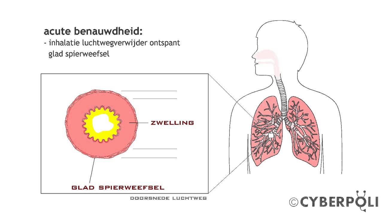 Kennis maken Grote hoeveelheid ZuidAmerika Astma - Behandeling met luchtwegverwijders | Cyberpoli