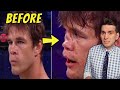 NOSE gets CRUSHED - Doctor Reacts to Michael Page Breaking Derek Anderson's Nose Bellator 258