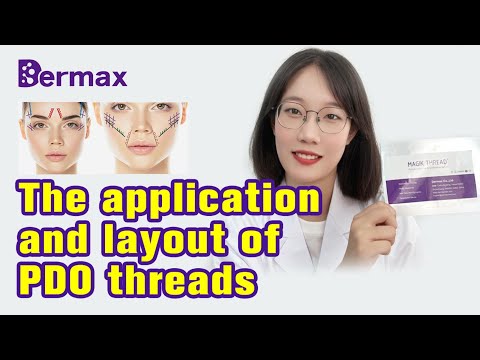 The application and layout of PDO threads|PDO Thread|Thread Lift|PDO Thread Lift|Med Spa