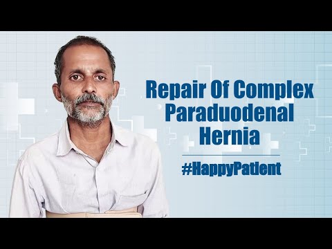 Paraduodenal Hernia Treatment in Kakinada | Medicover Hospitals - Video Thumbnail