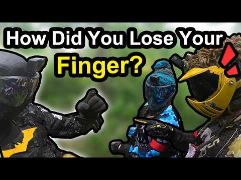 We Noticed He Was Missing Something… 😳 (Paintball Fails & Funny Moments)