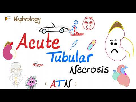 Acute Tubular Necrosis (ATN) - Azotemia - Acute Renal Failure (Acute Kidney Injury) - Nephrology