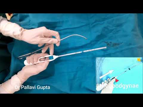 Mirena : how to insert| LNG-IUS | Hormonal IUD