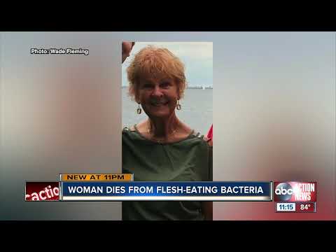 Doctors describe early warning signs of flesh-eating bacteria