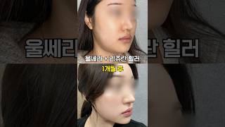 겨울철 필수 시술 조합 💯