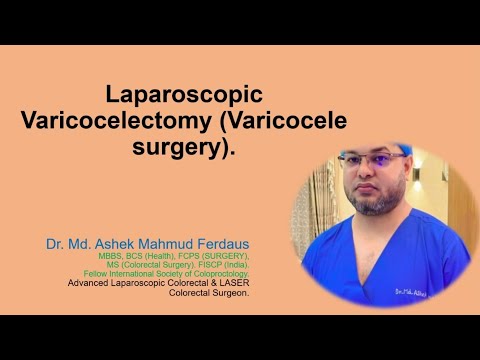 Laparoscopic varicocelectomy